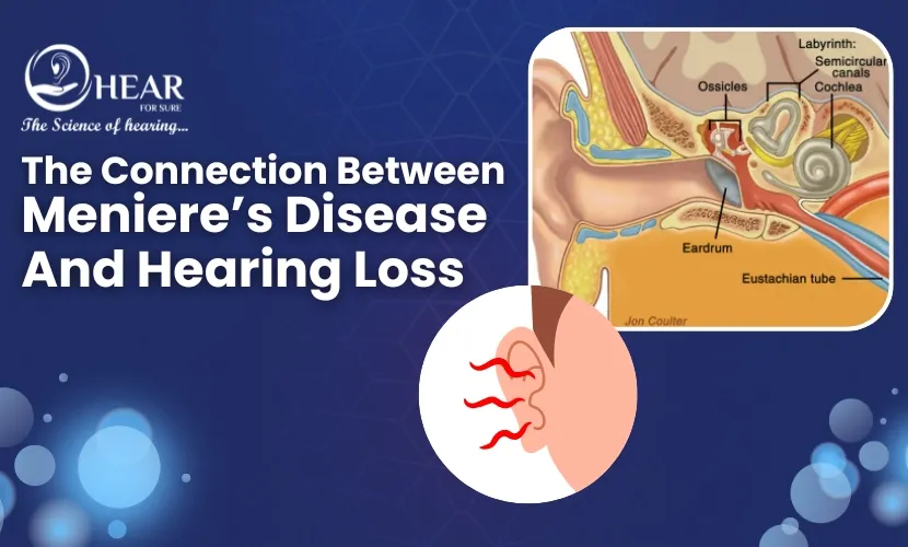 The Connection Between Meniere’s Disease and Hearing Loss Explained